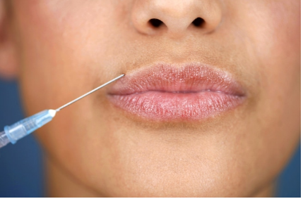 filler treatment